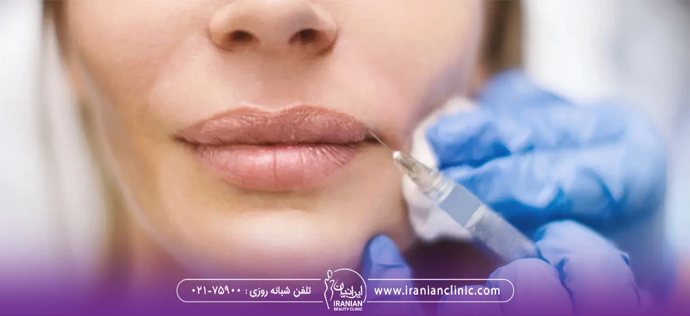 پزشکی که با یک سرنگ کوچک به لب بالای دختر فیلر تزریق می کند - تزریق ژل لب مدل هالیوودی