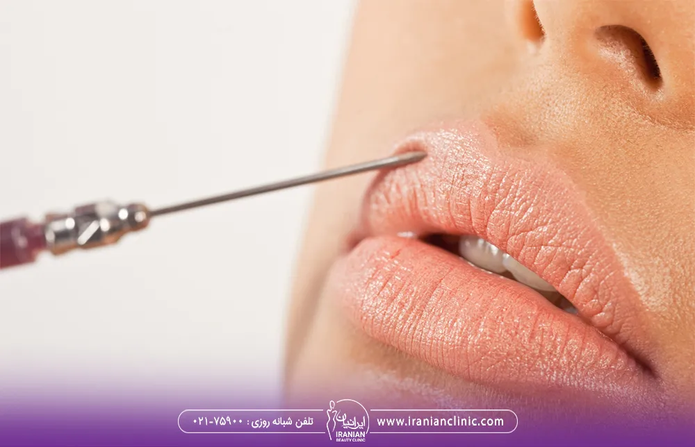 سرنگی که درون لب بالای زن فشار داده می شود