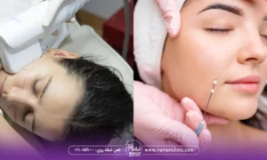 هایفوتراپی بهتر است یا لیفت با نخ