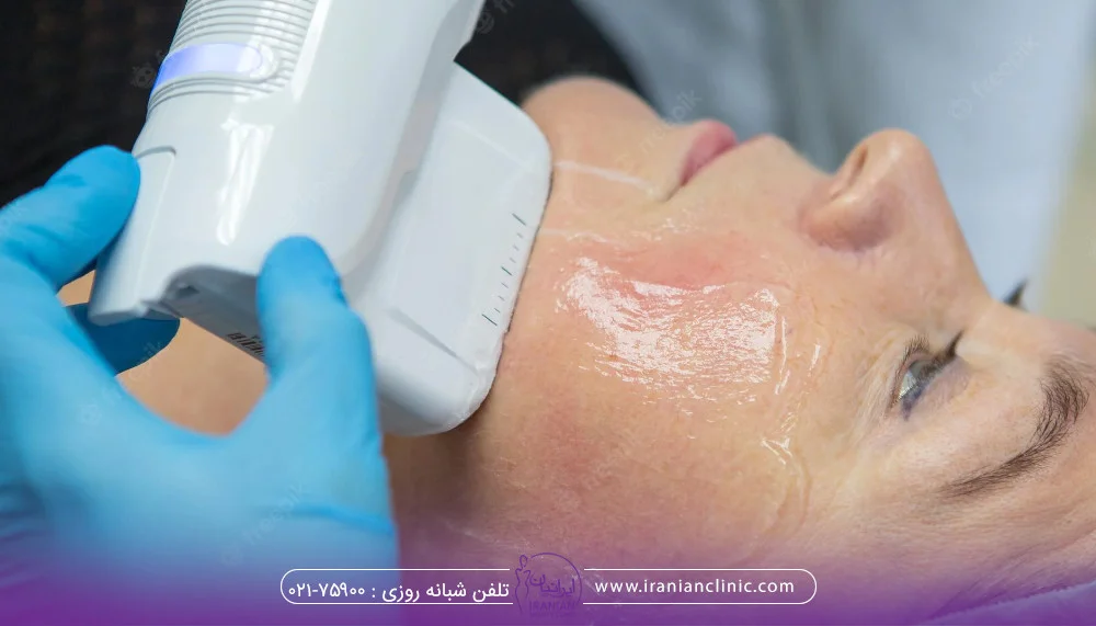 کاندید مناسب برای هایفوتراپی