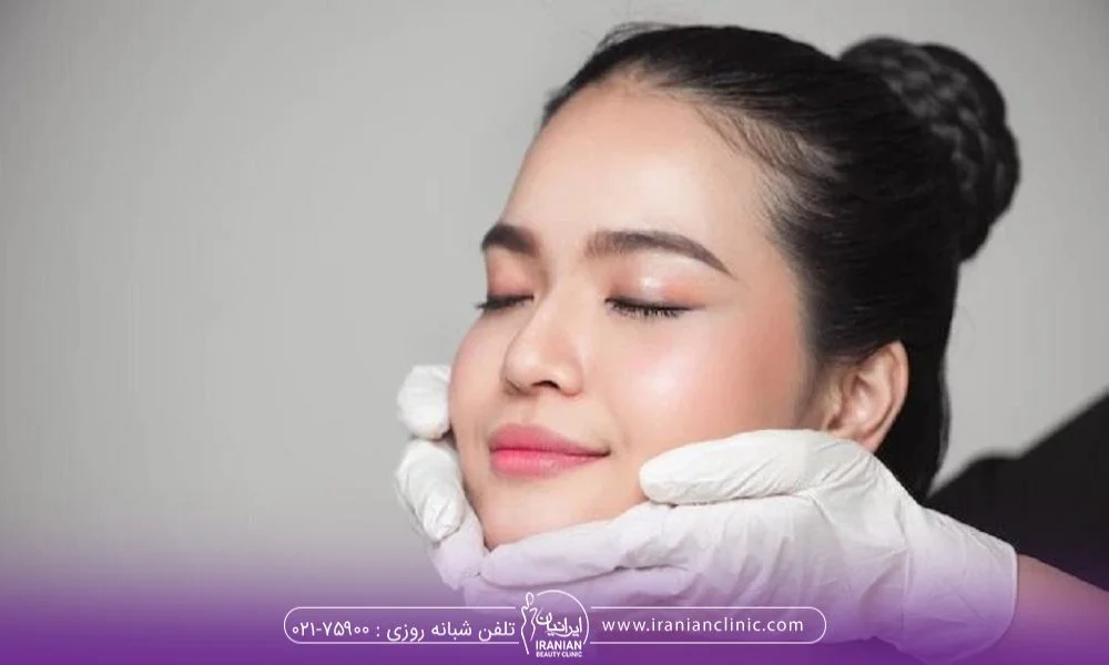 لیفت نخ صورت