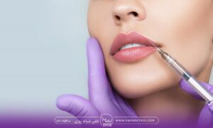 تزریق ژل لب چگونه انجام می شود؟