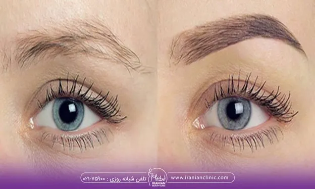 آیا بعد از کاشت ابرو می توان ابروها را رنگ کرد - رنگ کردن ابرو بعد از کاشت