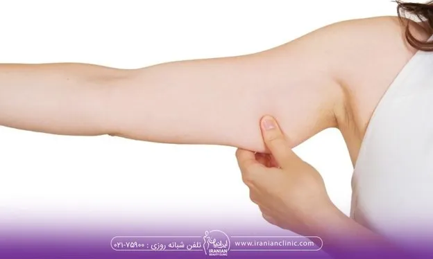 مراقبت های مهم بعد از براکیوپلاستی