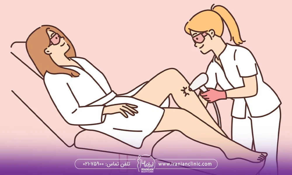 وکتور پزشکی که پاهای زن را لیزر می کند - لیزر موهای زائد