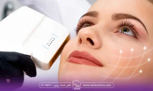 خانمی که در حال هایفو تراپی است