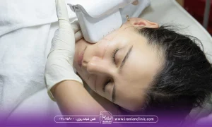 خانمی در حال انجام هایفو صورت و بینی ، مزایای انجام هایفوتراپی بینی