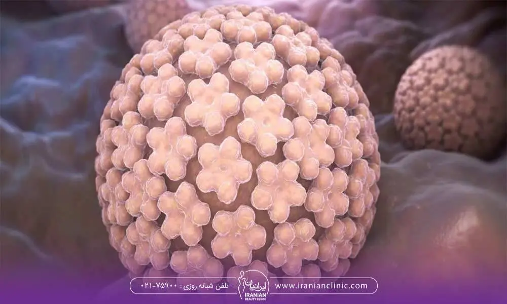 تصویری از ویروس HPV که عامل زگیل تناسلی است - لیزر و زگیل تناسلی
