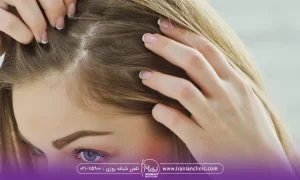 یک خانم که موهای خودرا چک میکند و از دو طرف با دستانش موهایش ر گرفته است