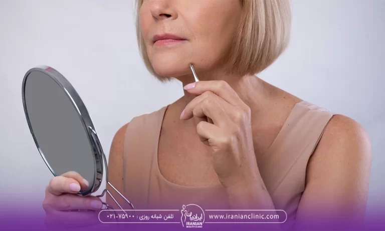 داشتن چانه بدون مو یکی از خواسته های بسیاری از خانم ها است که بوسیله درمان های مختلفی دست یافتنی است