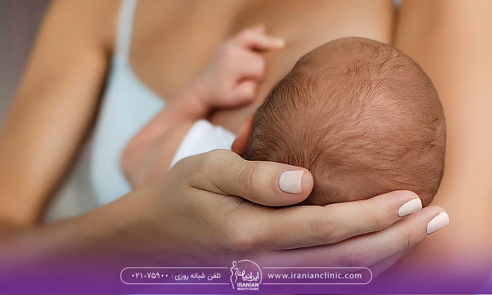 مادر جوان در حال شیر دادن به نوزاد خود - چرا لیزر برای بانوان شیرده ممنوع است؟