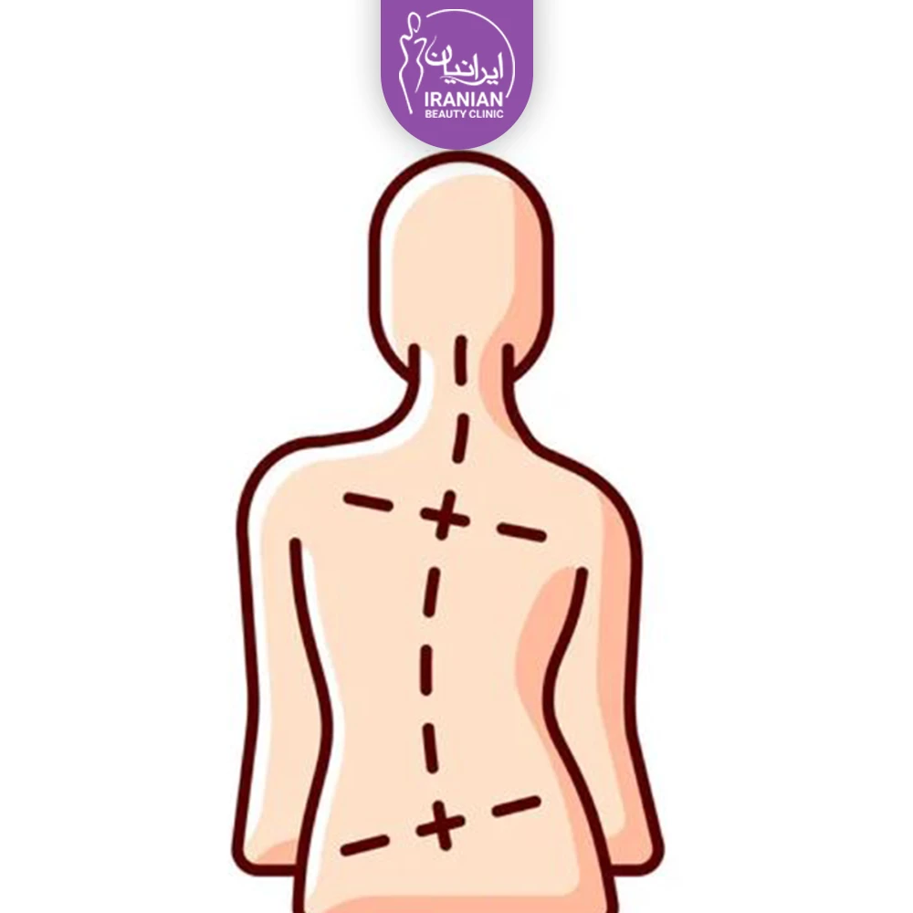 عکس وکتور از فرم بدن - پیکر تراشی