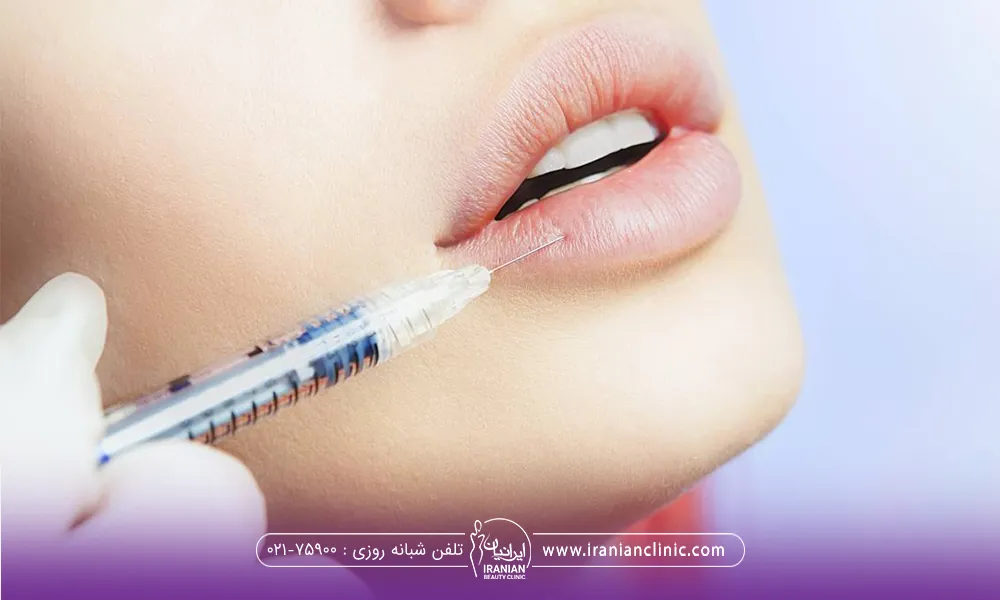 دستان دکتر که دستکش سفید دارد و سوزن را بر لب فرد گذاشته که تزریق ژل را انجام دهد