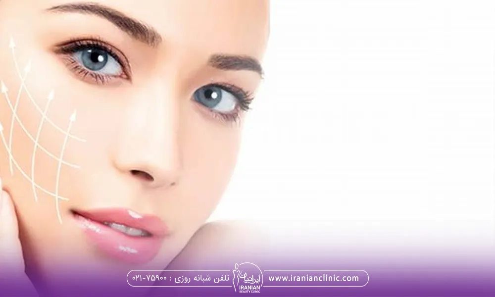 خانمی که بعد از انجام لیفت صورت با نخ به رو به رو نگاه میکند و دست خود زیر چانه اش است