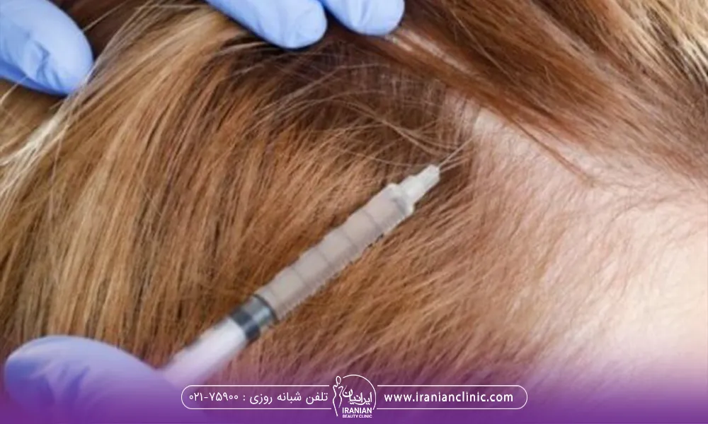 The cost of PRP hair