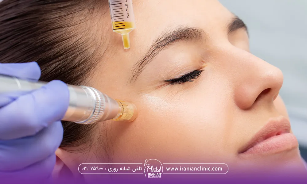 فردی که چشم هایش بسته است و دستان دکتر که دستکش به دست است در حال مزوتراپی صورت وی میباشد