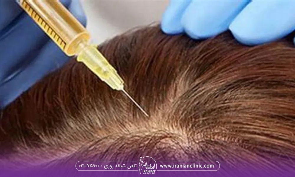 پزشکی که در حال تزریق پب ار پی روی سر یک فرد است