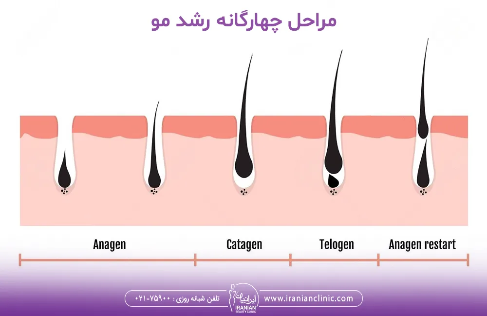 تصویر مراحل چهارگانه رشد مو