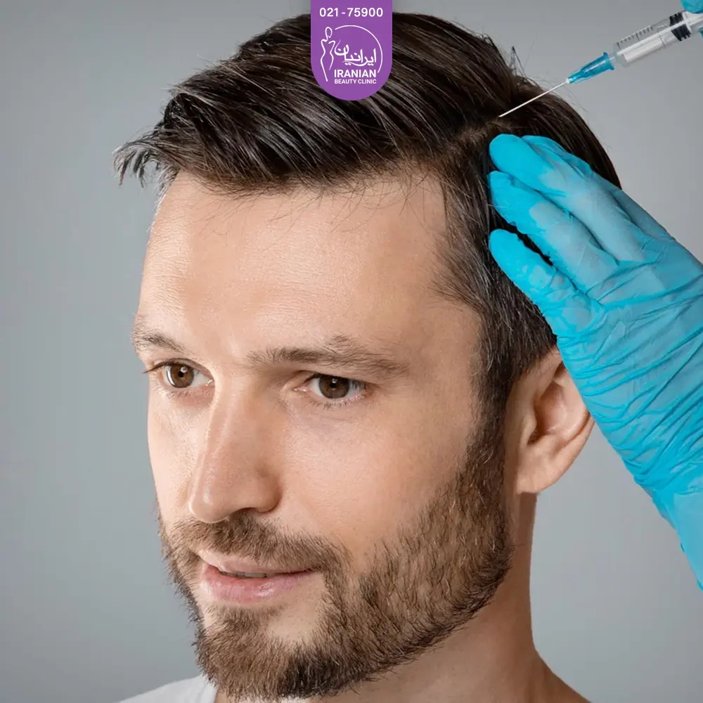 پزشک در حال تزریق آمپول مزوتراپی به موی مرد جوان - مزوتراپی مو
