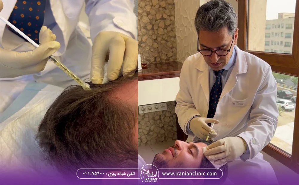 عکس پزشک در کلینیک زیبایی ایرانیان در حال تزریق پی آر پی موی سر