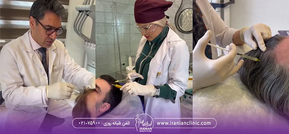 3 عکس کنار هم از پزشک ها در حال prp موی سر