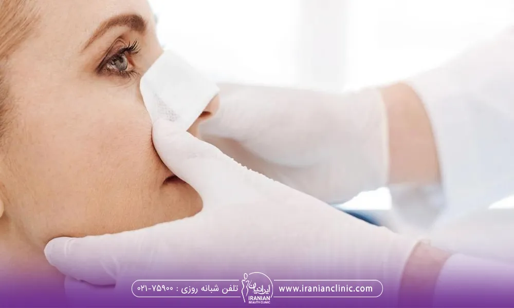 خانمی که بعد از انجام فیلر به دکتر مراجعه کرده برای یاد گرفتن طرز چسب زدن به بینی