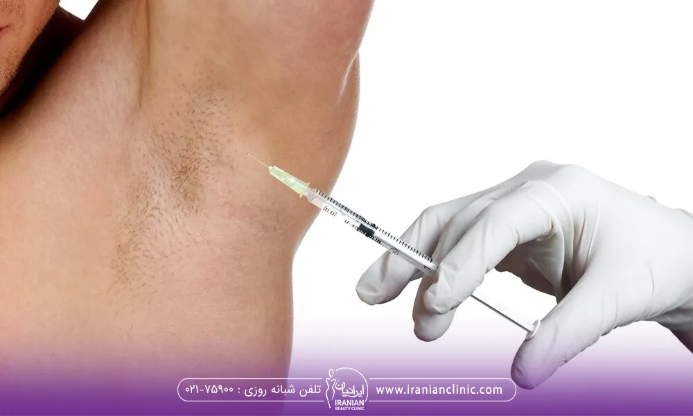 تزریق بوتاکس زیر بغل برای چه کسانی مناسب است؟
