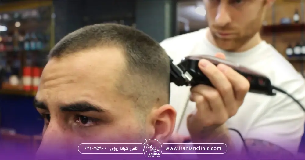 آرایشگر در حال اصلاح موی مرد بعد از کاشت مو - سن کاشت مو مردان