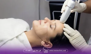 دختری در حال انجام لاغری صورت! آیا هایفو صورت را لاغر میکنه؟
