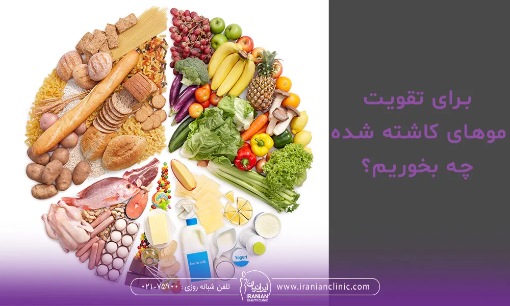 تغذیه برای تقویت موهای کاشته شده چگونه است ؟