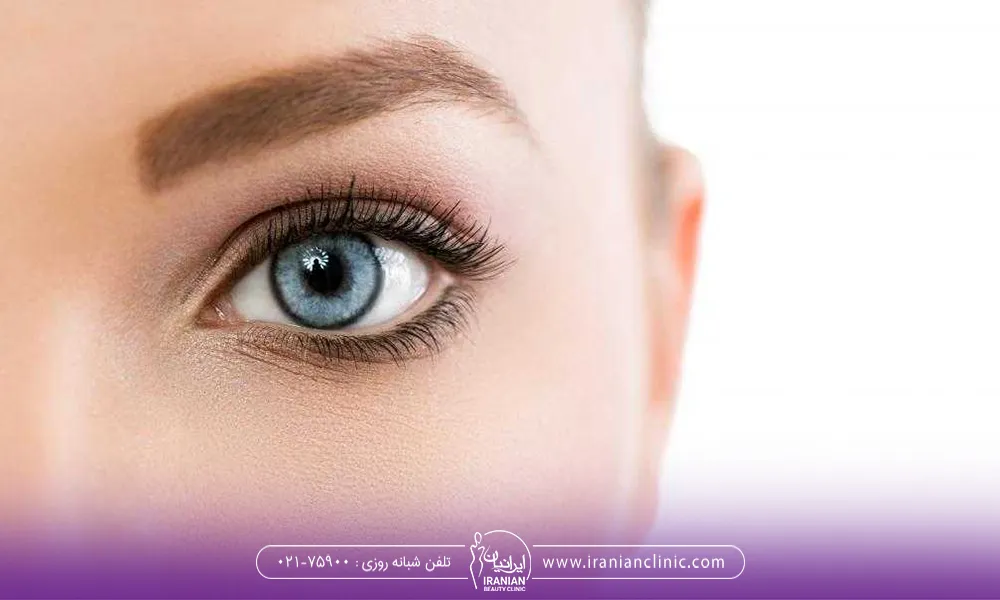 چطور بعد از کاشت ابرو از ریزش آن جلوگیری کنیم ؟