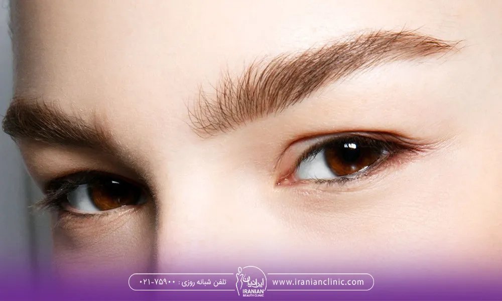 توصیه ها و مراقبت های جلوگیری از ریزش ابرو بعد از کاشت