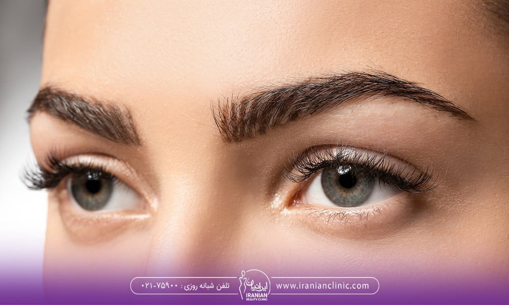 ابرو های کاشته شده چند سال دوام دارند ؟