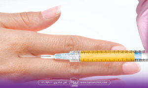 تزریق چربی برای کدام نواحی بدن مناسب است