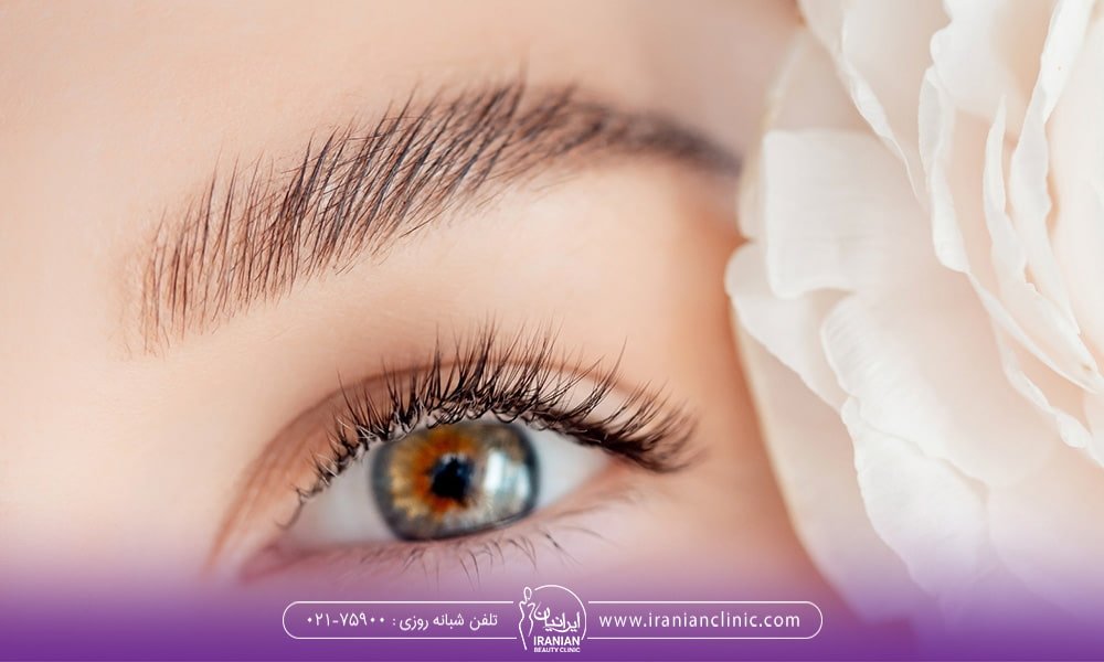 میکروبلیدینگ