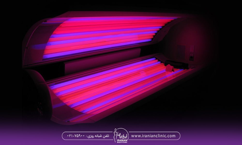 تاثیر سولار و آفتاب گرفتن بر روی ژل لب تزریقی 