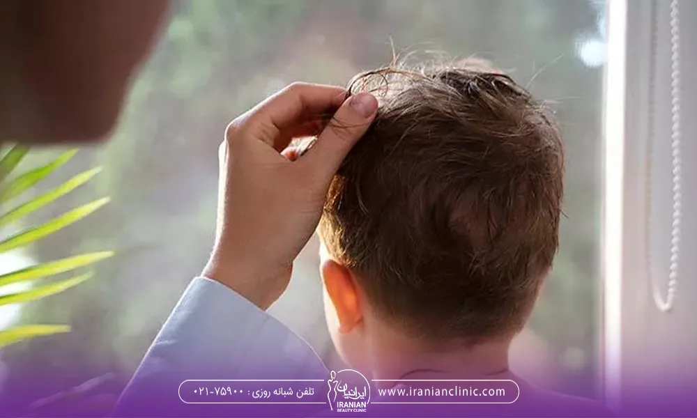 نازک شدن موی کودکان