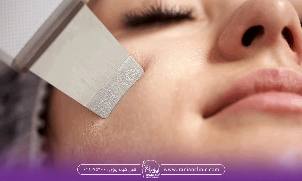 درما اف صورت