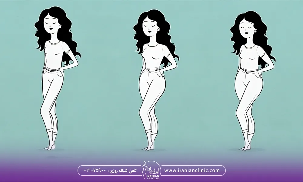 چگونه چاق شویم