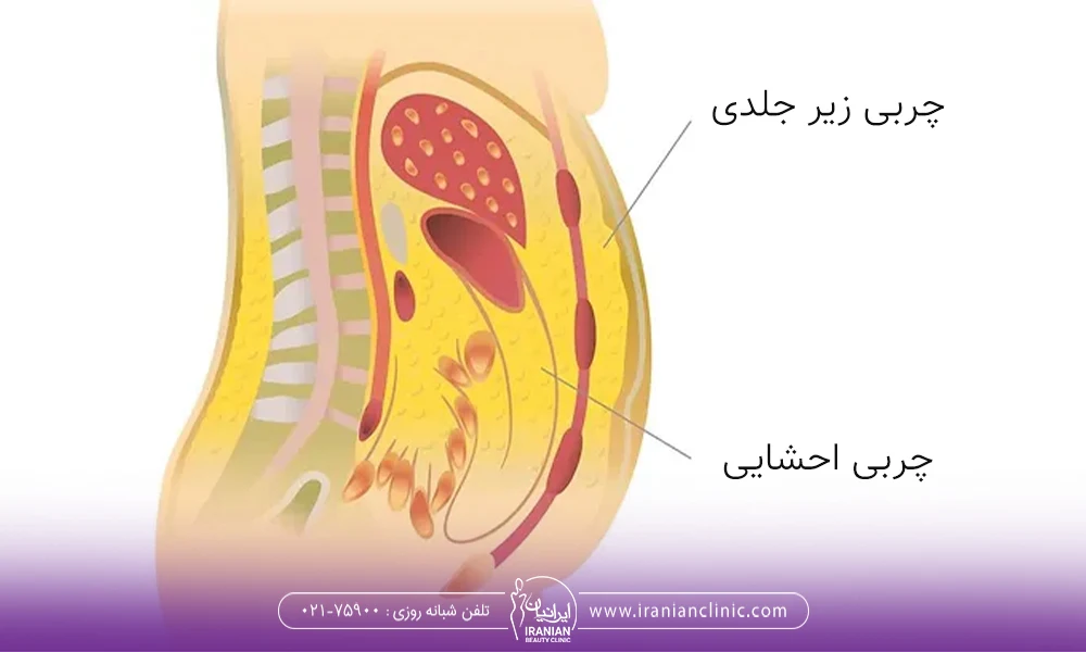 چربی زیر جلدی و احشایی
