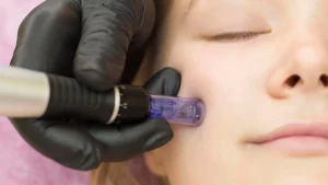 خانمی که توسط اپراتور کار میکروندلینگ انجام میدهد