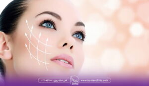 تصویر یه دختر است با چشمای آبی و موی مشکی با پوست زیبا و صاف با بک گراند هلویی- اندولیفت بهتر است یا هایفو؟