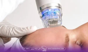 اپراتوری برای یک خانم ار اف فر کشنال انجام میدهد