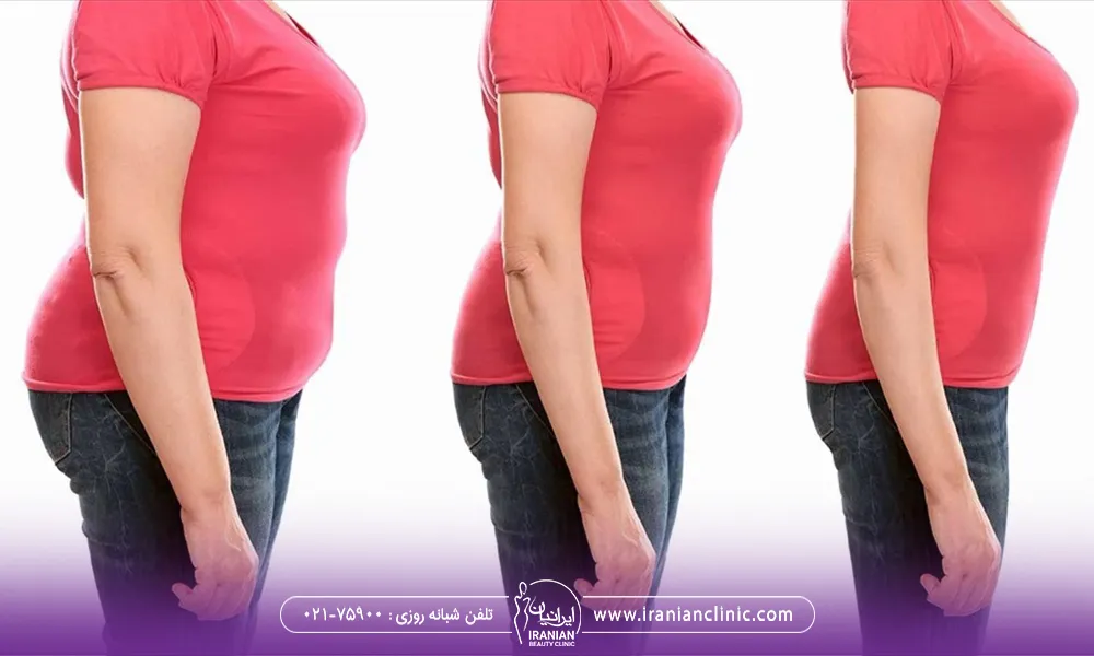 عکس بدن زن در 3 وزن مختلف - لاغری سریع