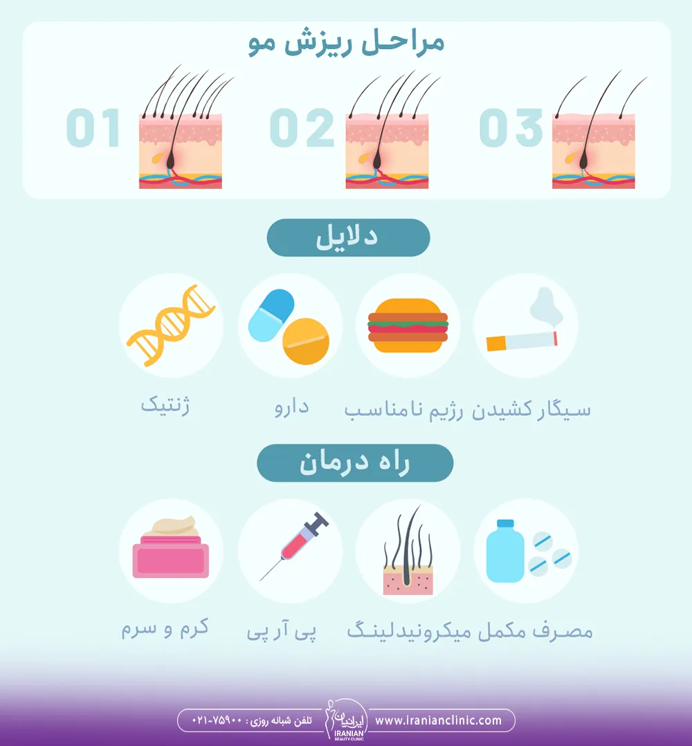 مراحل ریزش مو و دلایل ریزش و راه درمان ریزش مو
