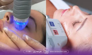 دو خانم در حال انجام ار اف و هایفو، آر اف بهتر است یا هایفو؟ چرا؟