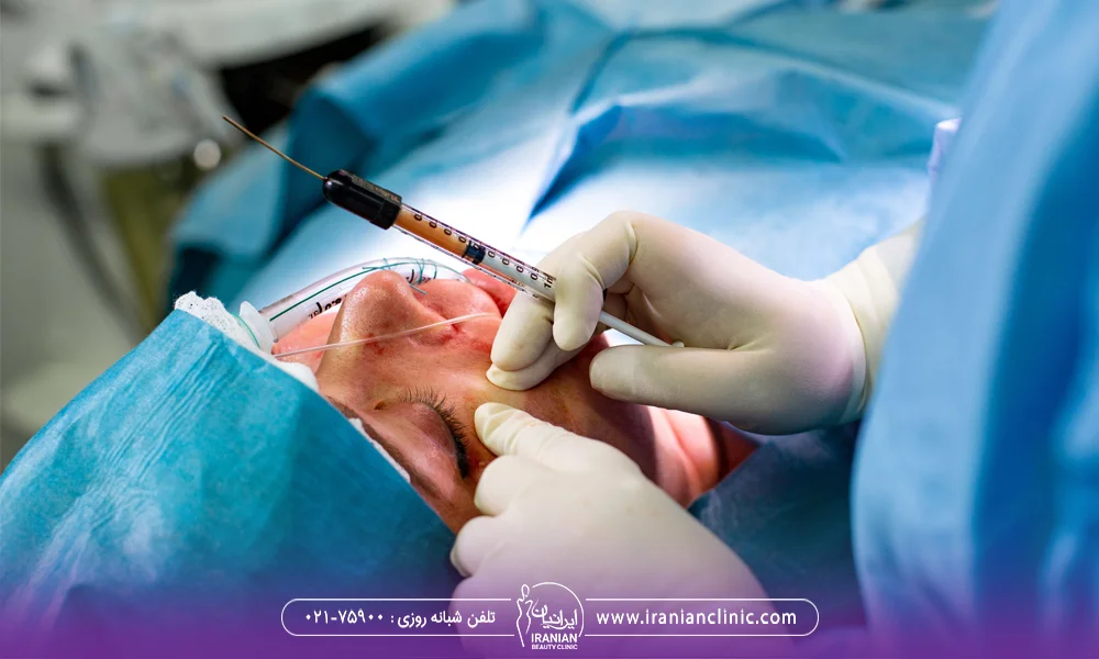 تزریق چربی به صورت توسط پزشک - برای زاویه سازی صورت ژل بهتر است یا چربی