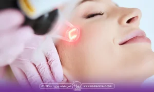 What is the number of laser shots for the whole body