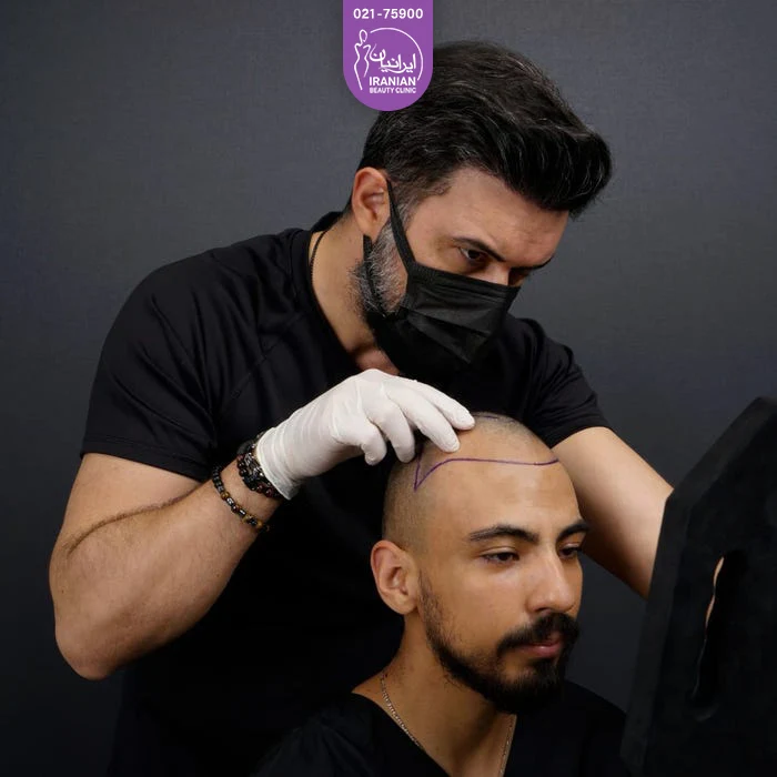 پزشکی که وضعیت طاسی سر مرد جوان را بررسی می کند - کاشت مو به روش fit