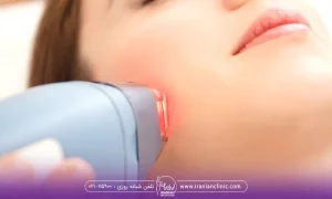 خانمی که دراز کشیده و توسط اپراتور صورتش را لیزر میکند